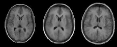 \includegraphics[%
scale=0.4]{EPS/brain_0_cps.eps}