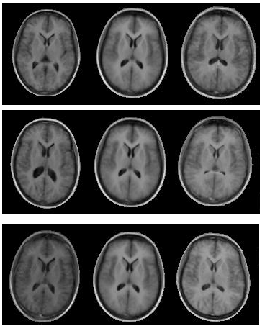 Image aam_brain_set_modes_1-3
