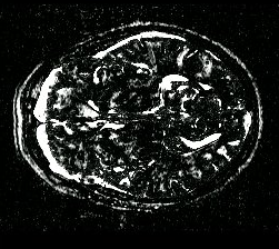 Image accumulated_difference_image_slice