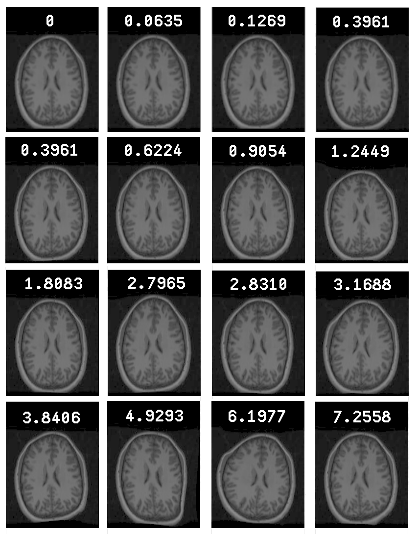Image example_warp_mangnitude_brains_16