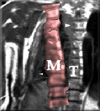 \includegraphics[scale=0.7]{Graphics/model}