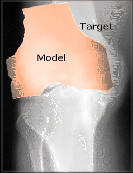 \includegraphics[scale=0.7]{Graphics/aam}
